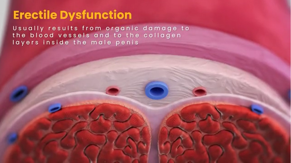 הפין במצב זקפה