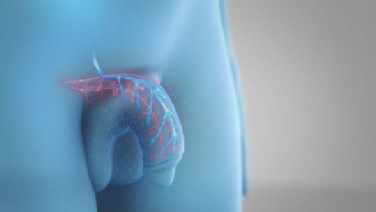 האיבר במצב רפוי (מנגנון נעילת הדם רפוי ולא מאפשר נעילה של הדם באיבר)