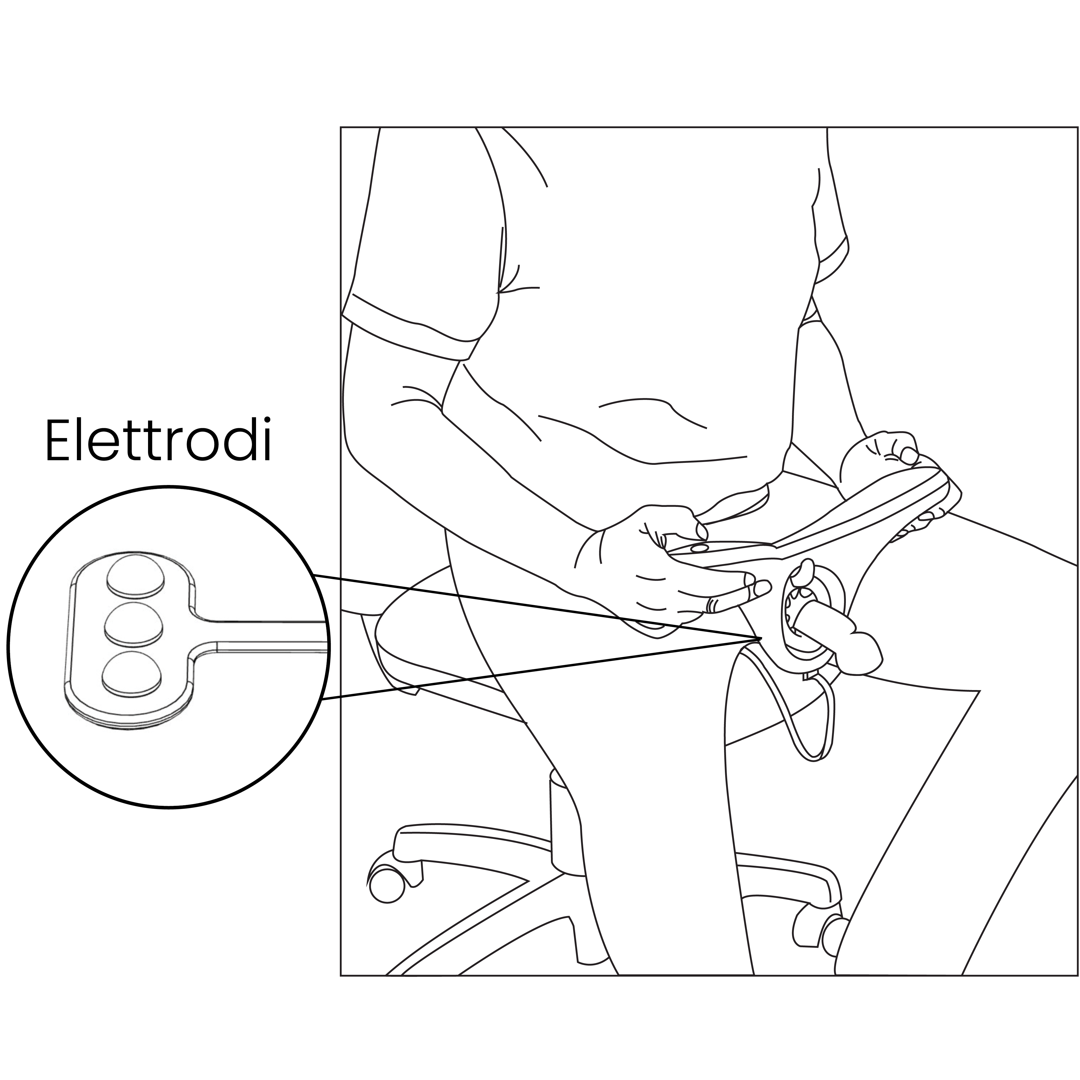 TRATTAMENTO: MODALITÀ RING E PAD